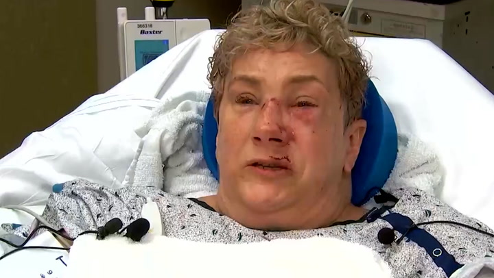 ‘I thought I was going to die’: Pennsylvania woman survives bear attack in garden