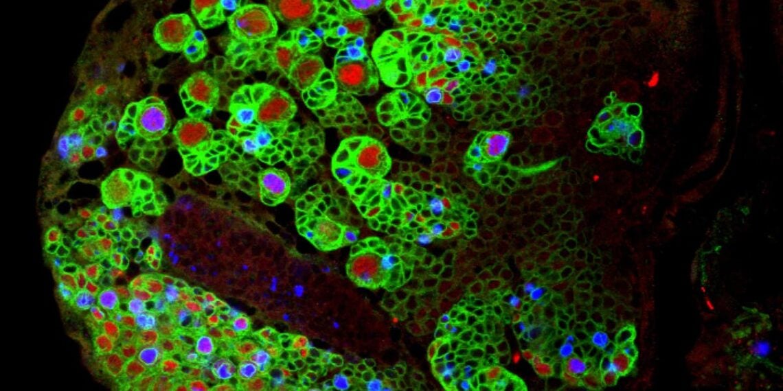 Os pequenos insetos que podem conter o segredo para curar tumores cerebrais