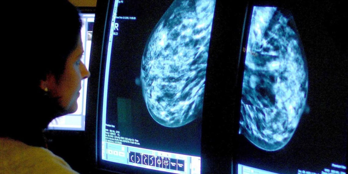 Sobreviventes de cancro da mama correm risco significativo de desenvolver cancros inteiramente novos