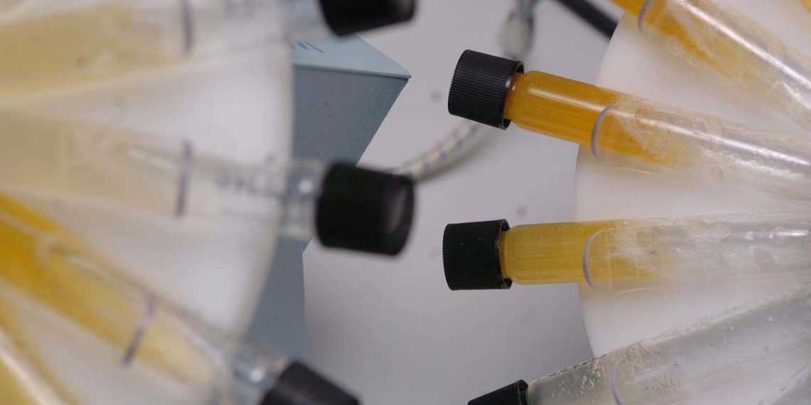 Teste simples de urina ‘poderia ajudar a evitar biópsias desnecessárias de câncer de próstata’