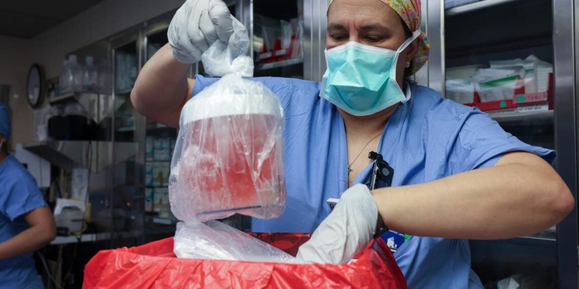 Primeira pessoa a fazer um transplante de rim de porco geneticamente modificado morre meses depois