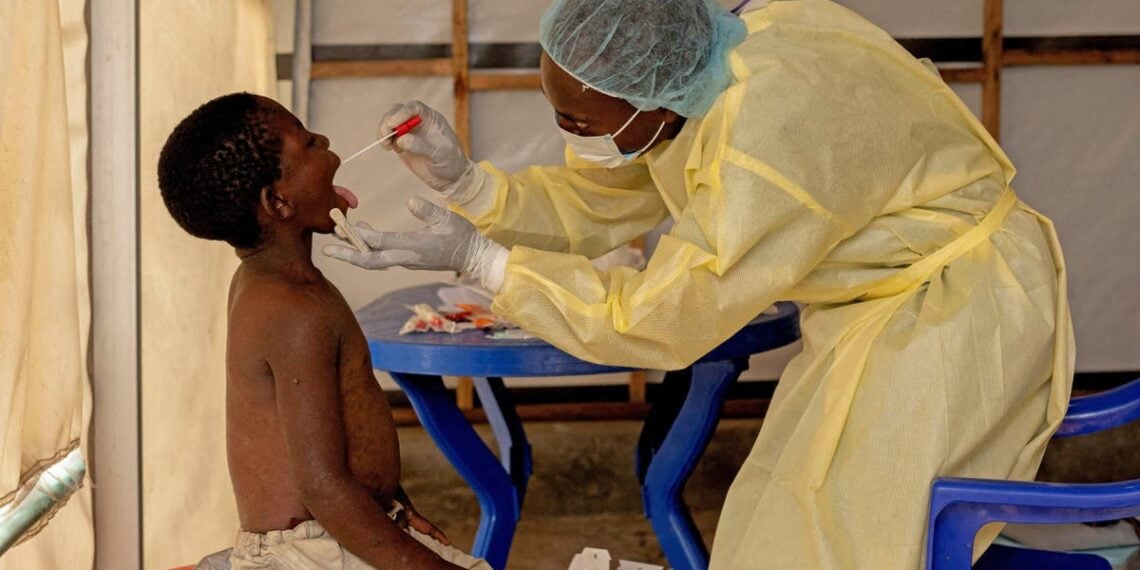 Surto de mpox no Reino Unido em 2022: onde os casos começaram e como a infecção se espalhou para 3.000 pessoas